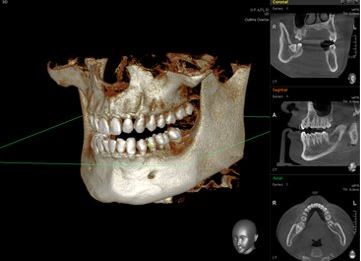 3D CT